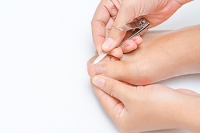 Causes and Management of Ingrown Toenails