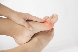 Women and Bunions