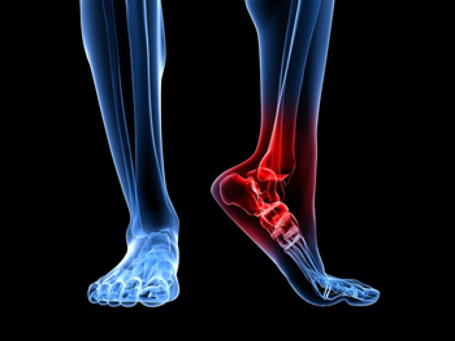 Sports Foot Injuries | Florida Orthopaedic Institute
